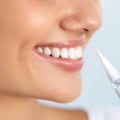 The Most Effective Teeth Whitening Solutions